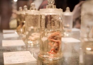 2026年贵州医科大学附属医院试管婴儿费用高吗？