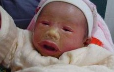 湛江久和医院做试管婴儿要多少钱？(2026湛江试管费用参考)