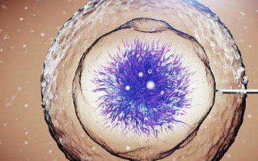 太仓市生孩子做染色体检查有必要吗，筛查一次大概需要多少钱？